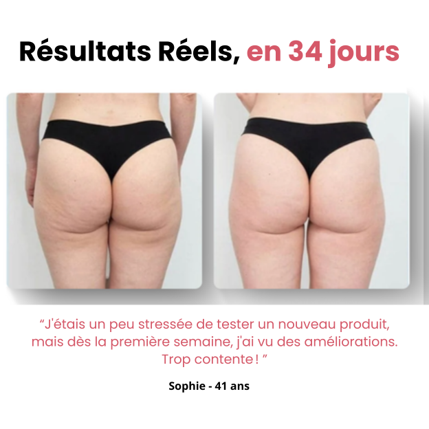 Masseur Anti-Cellulite Naurella™