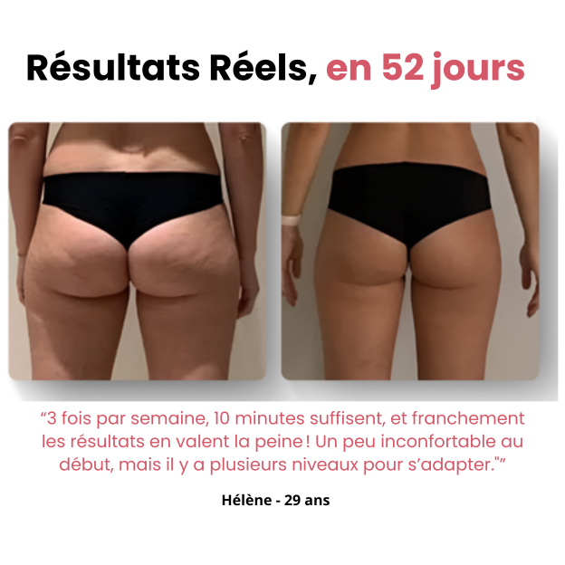 Masseur Anti-Cellulite Naurella™