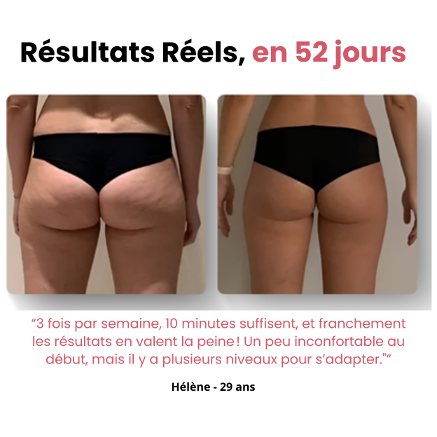 Naurella™ – Masseur Anti-Cellulite